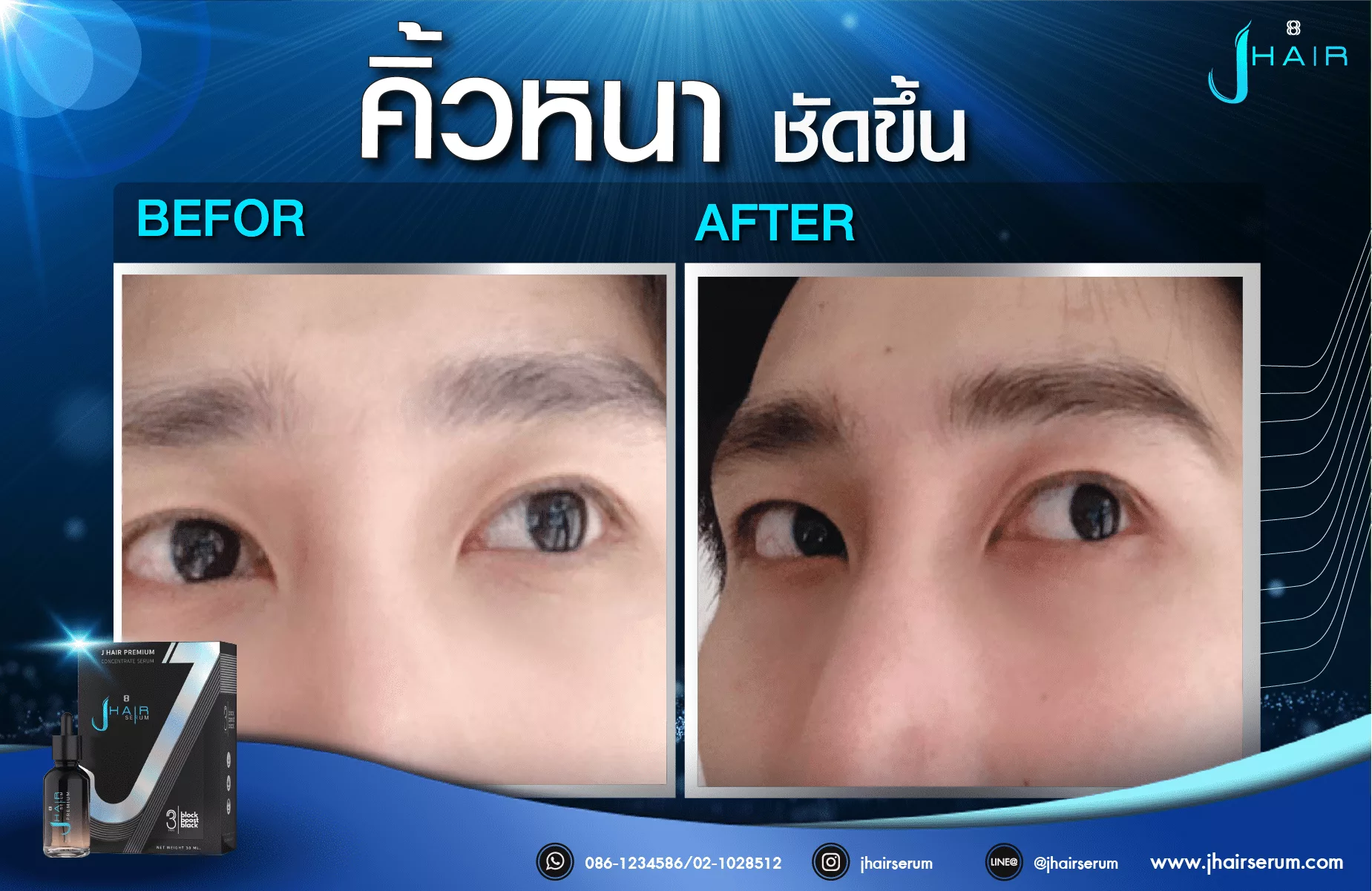 รีวิวจากผู้ใช้จริง J HAIR SERUM เซรั่มปลูกผม