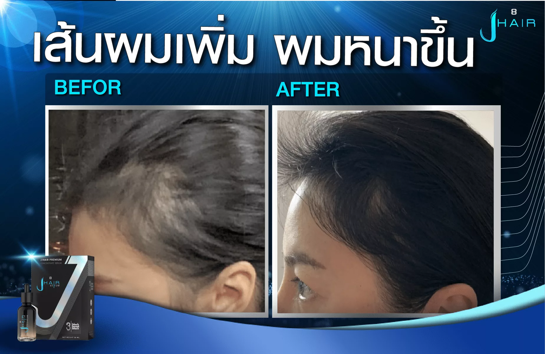 รีวิวจากผู้ใช้จริง J HAIR SERUM เซรั่มปลูกผม